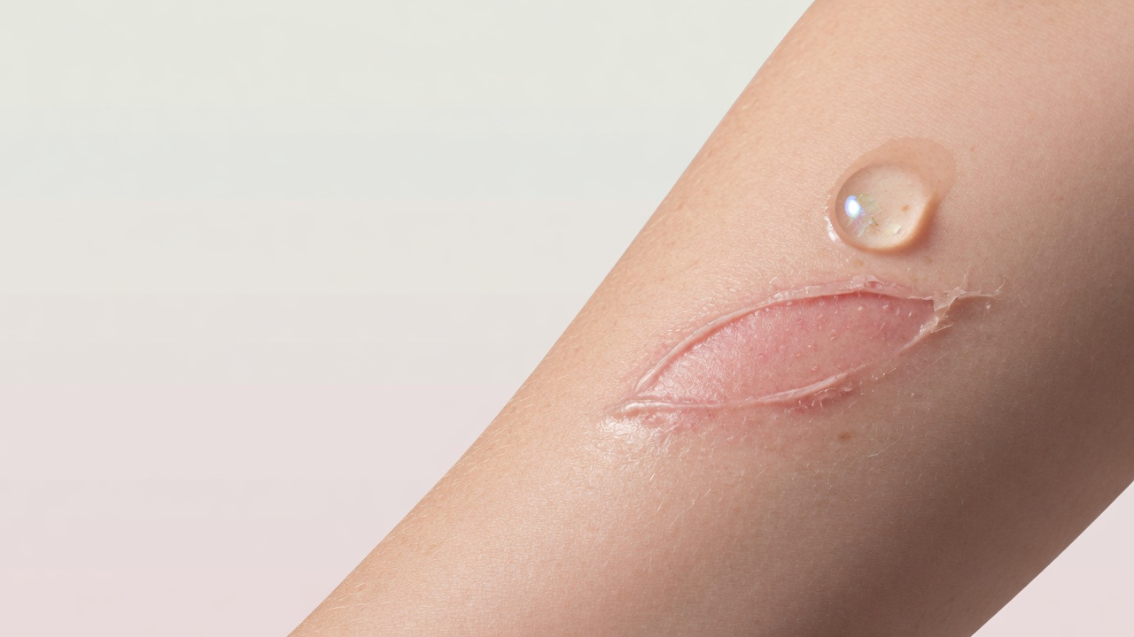 How does skin regeneration work and what speeds up the healing process?